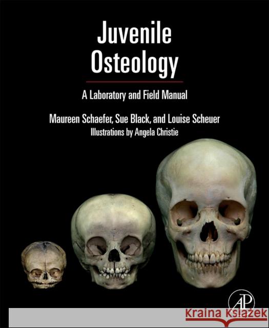 Juvenile Osteology : A Laboratory and Field Manual Louise Scheuer Sue M. Black 9780123746351 ELSEVIER SCIENCE & TECHNOLOGY