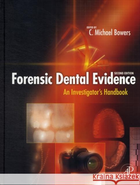 Forensic Dental Evidence: An Investigator's Handbook Bowers, C. Michael 9780123820006 0