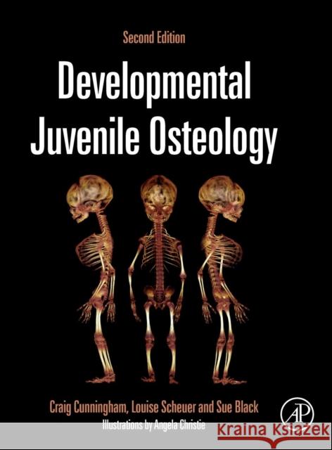 Developmental Juvenile Osteology Craig Cunningham Louise Scheuer Sue Black 9780123821065 Academic Press