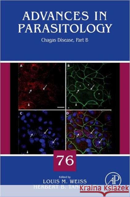 Chagas Disease: Part B Volume 76 Weiss, Louis M. 9780123858955