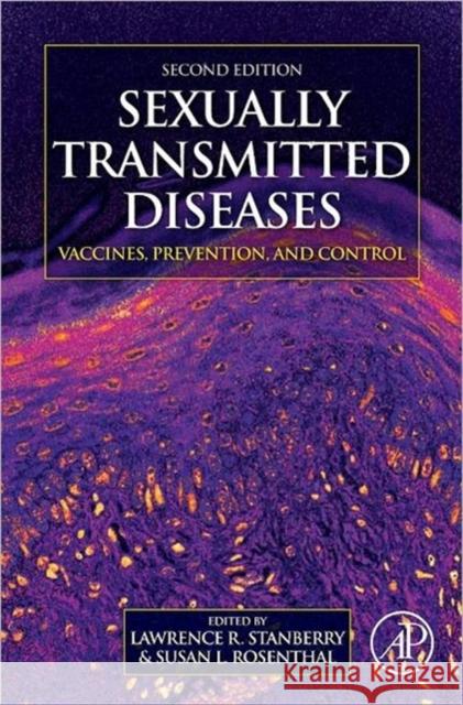 Sexually Transmitted Diseases: Vaccines, Prevention, and Control Stanberry, Lawrence R. 9780123910592 Academic Press