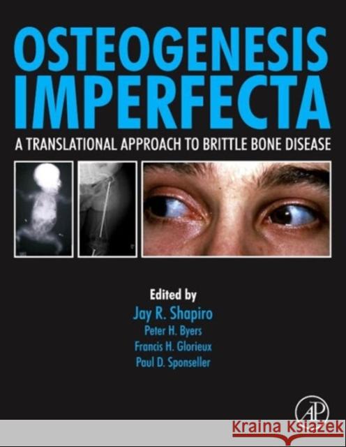 Osteogenesis Imperfecta: A Translational Approach to Brittle Bone Disease Shapiro, Jay R. 9780123971654 0