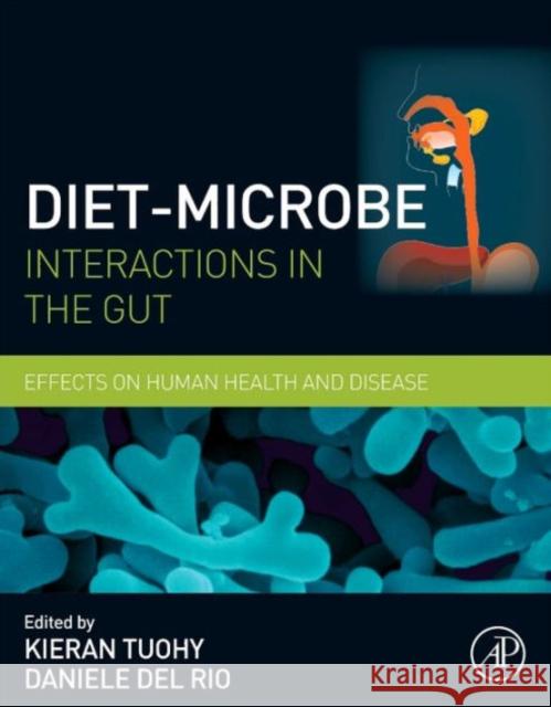 Diet-Microbe Interactions in the Gut: Effects on Human Health and Disease Tuohy, Kieran 9780124078253 ACADEMIC PRESS