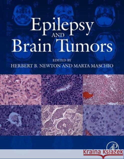 Epilepsy and Brain Tumors Newton, Herbert B Maschio, Marta  9780124170438