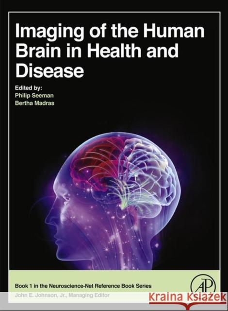 Imaging of the Human Brain in Health and Disease Seeman, Philip Madras, Bertha  9780124186774