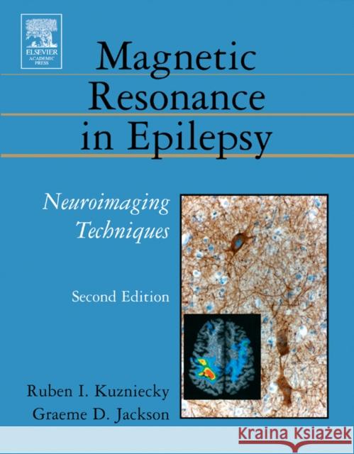 Magnetic Resonance in Epilepsy: Neuroimaging Techniques Kuzniecky, Ruben 9780124311527 Academic Press