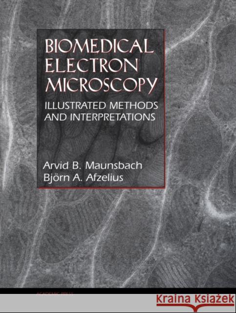 Biomedical Electron Microscopy: Illustrated Methods and Interpretations Arvid B Maunsbach 9780124806108 0