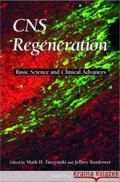 CNS Regeneration: Basic Science and Clinical Advances Tuszynski, Mark H. 9780127050706 Academic Press