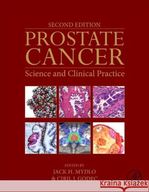 Prostate Cancer: Science and Clinical Practice Mydlo, Jack H. Godec, Ciril J.  9780128000779 Elsevier Science