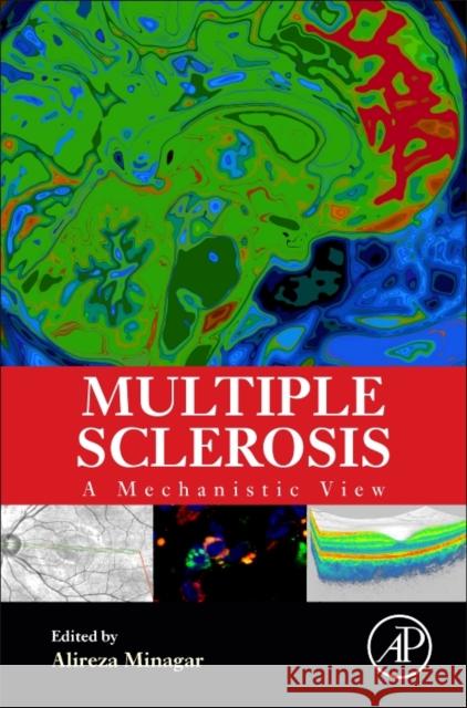 Multiple Sclerosis: A Mechanistic View Minagar, Alireza   9780128007631