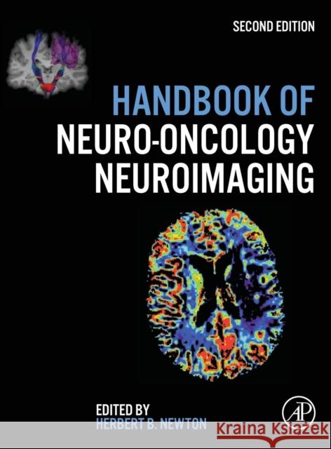 Handbook of Neuro-Oncology Neuroimaging Herbert B. Newton 9780128009451