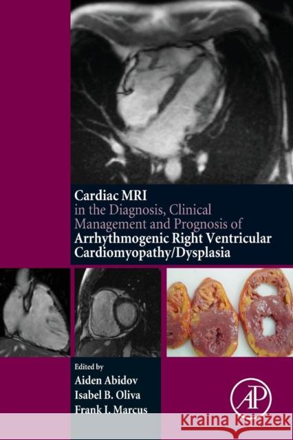 Cardiac MRI in Diagnosis, Clinical Management, and Prognosis of Arrhythmogenic Right Ventricular Cardiomyopathy/Dysplasia Abidov, Aiden Oliva, Isabel MARCUS, FRANK I 9780128012833