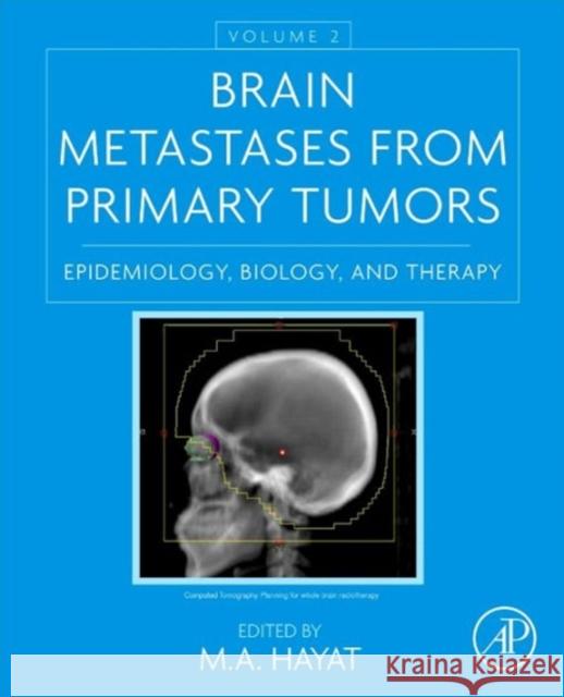 Brain Metastases from Primary Tumors, Volume 2: Epidemiology, Biology, and Therapy Hayat, M. A. 9780128014196 Academic Press