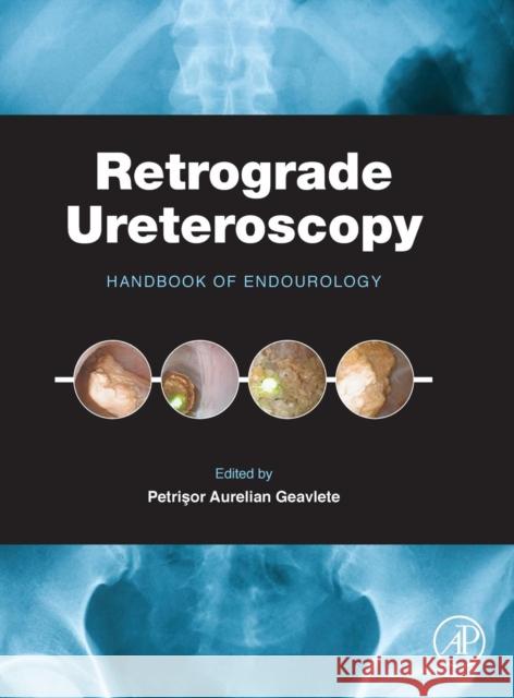 Retrograde Ureteroscopy: Handbook of Endourology Petrisor Aurelian Geavlete 9780128024034 ACADEMIC PRESS