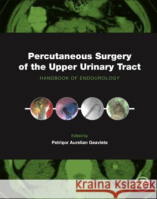 Percutaneous Surgery of the Upper Urinary Tract: Handbook of Endourology Geavlete, Petrisor Aurelian 9780128024041