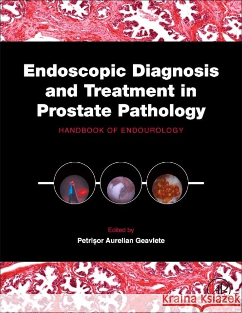 Endoscopic Diagnosis and Treatment in Prostate Pathology: Handbook of Endourology Geavlete, Petrisor Aurelian   9780128024058 Elsevier Science