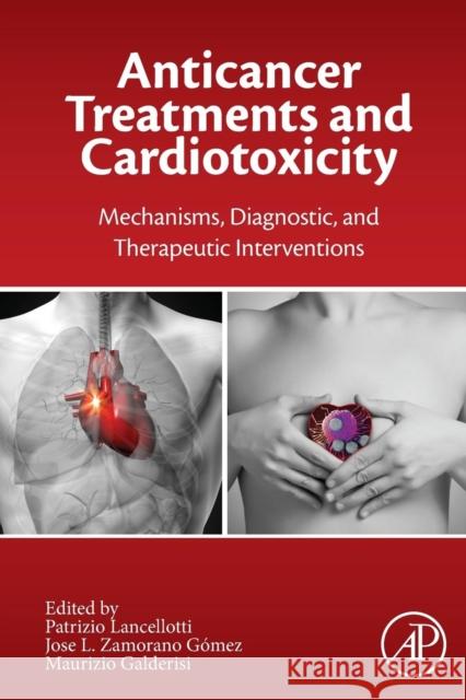Anticancer Treatments and Cardiotoxicity: Mechanisms, Diagnostic and Therapeutic Interventions Lancellotti, Patrizio 9780128025093 Elsevier Science