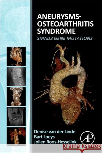 Aneurysms-Osteoarthritis Syndrome: Smad3 Gene Mutations Van Derlinde, Denise 9780128027080 Elsevier