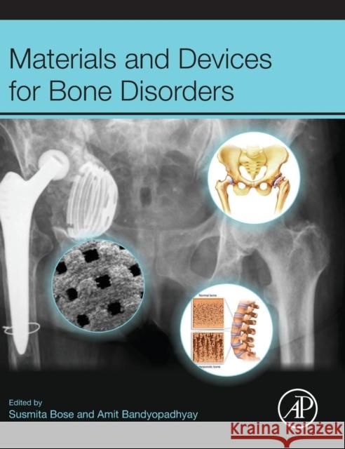 Materials and Devices for Bone Disorders Susmita Bose Amit Bandyopadhyay 9780128027929