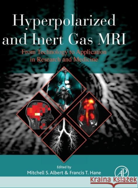 Hyperpolarized and Inert Gas MRI: From Technology to Application in Research and Medicine Albert, Mitchell S. 9780128036754