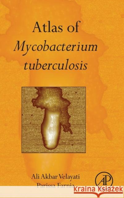 Atlas of Mycobacterium Tuberculosis Ali Akbar Velayati Parissa Farnia 9780128038086 Academic Press