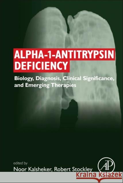 Alpha-1-Antitrypsin Deficiency: Biology, Diagnosis, Clinical Significance, and Emerging Therapies Noor Kalsheker Robert Andrew Stockley 9780128039427 Academic Press