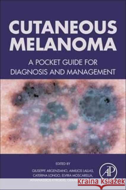 Cutaneous Melanoma: A Pocket Guide for Diagnosis and Management Giuseppe Argenziano 9780128040003 Academic Press