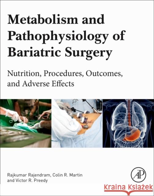 Metabolism and Pathophysiology of Bariatric Surgery: Nutrition, Procedures, Outcomes and Adverse Effects Preedy, Victor R. 9780128040119