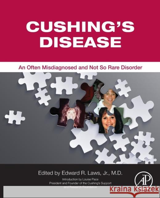 Cushing's Disease: An Often Misdiagnosed and Not So Rare Disorder Laws Jr, Edward R. 9780128043400