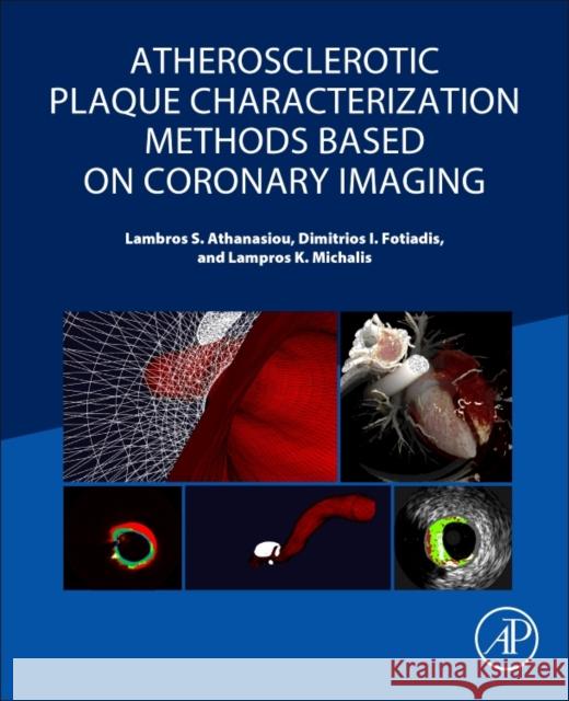 Atherosclerotic Plaque Characterization Methods Based on Coronary Imaging Lambros S. Athanasiou Dimitrios I. Fotiadis Lampros K. Michalis 9780128047347 Academic Press