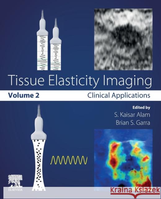 Tissue Elasticity Imaging: Volume 2: Clinical Applications S. Kaisar Alam Brian S. Garra 9780128096628 Elsevier