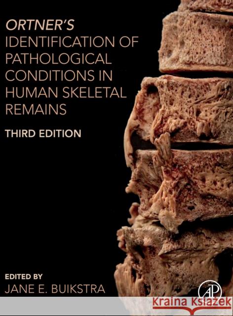Ortner's Identification of Pathological Conditions in Human Skeletal Remains Jane E. Buikstra 9780128097380 Academic Press