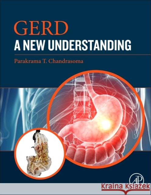 GERD A New Understanding of Pathology, Pathophysiology, and Treatment Chandrasoma, Parakrama T. (Keck School of Medicine, University of Southern California, Los Angeles, CA, USA) 9780128098554