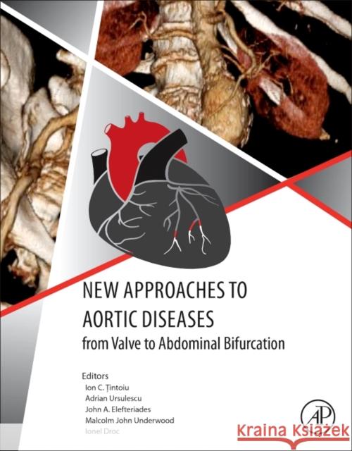 New Approaches to Aortic Diseases from Valve to Abdominal Bifurcation Ion C. Țintoiu John A. Elefteriades Adrian Ursulescu 9780128099797