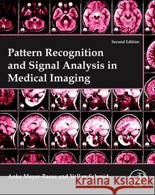 Pattern Recognition and Signal Analysis in Medical Imaging Anke Meyer-Baese Volker J. Schmid 9780128101162