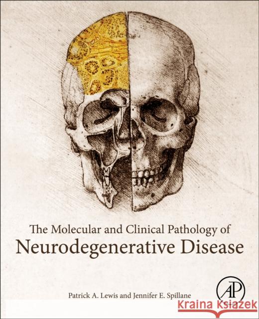 The Molecular and Clinical Pathology of Neurodegenerative Disease Patrick a. Lewis Jennifer E. Spillane 9780128110690