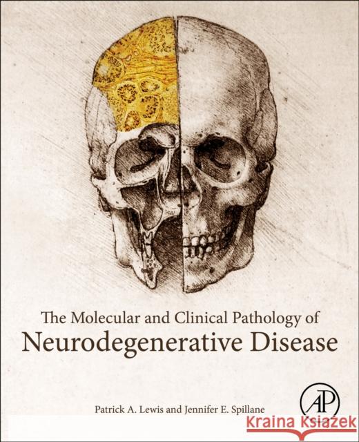 The Molecular and Clinical Pathology of Neurodegenerative Disease Patrick a. Lewis Jennifer E. Spillane 9780128110690 Academic Press