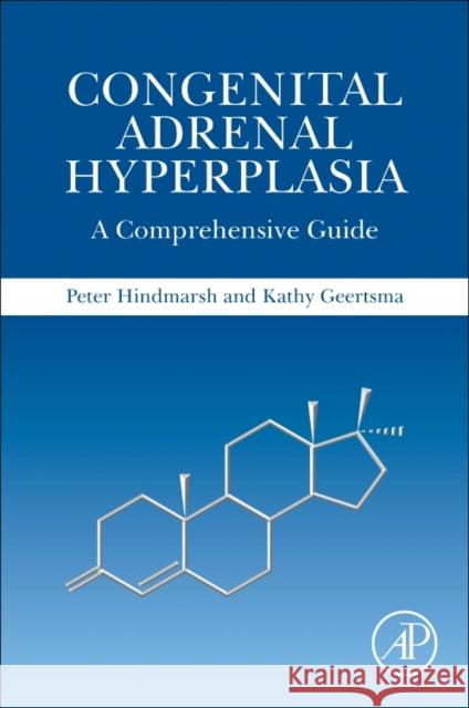 Congenital Adrenal Hyperplasia: A Comprehensive Guide Peter C. Hindmarsh Kathy Geertsma 9780128114834 Academic Press