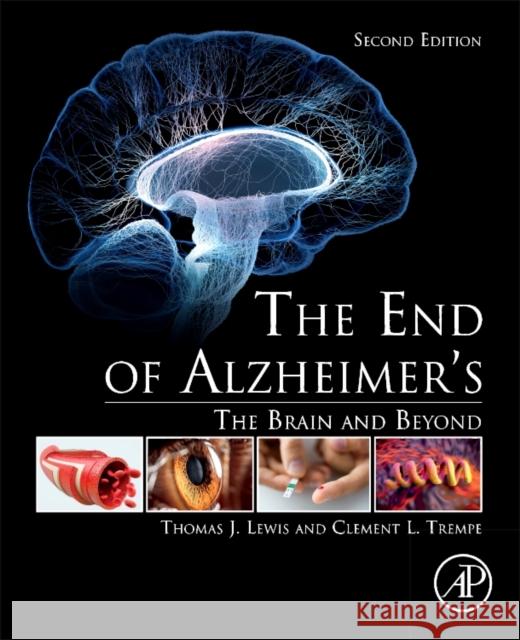 The End of Alzheimer's: The Brain and Beyond Lewis, Thomas J. 9780128121122 Academic Press