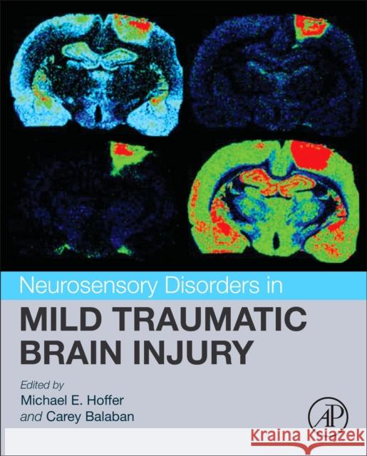 Neurosensory Disorders in Mild Traumatic Brain Injury Michael E. Hoffer Carey Balaban 9780128123447 Academic Press