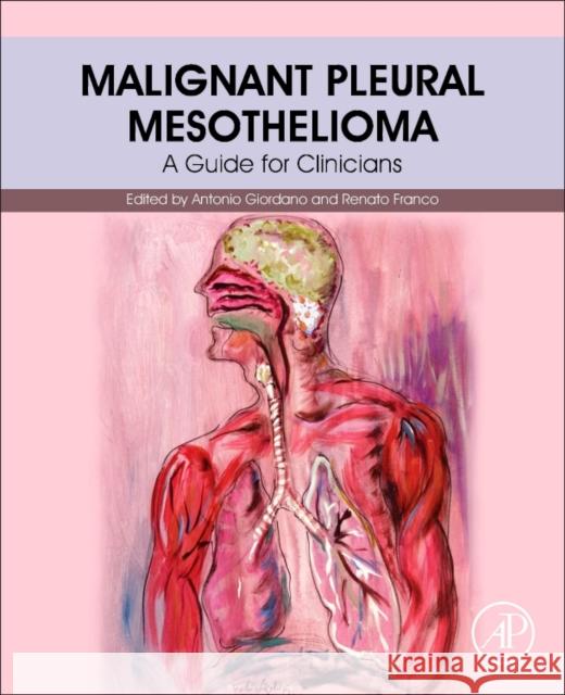Malignant Pleural Mesothelioma: A Guide for Clinicians Antonio Giordano Renato Franco 9780128127247