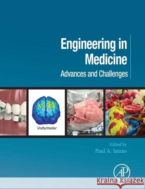 Engineering in Medicine: Advances and Challenges Paul Iaizzo 9780128130681 Academic Press