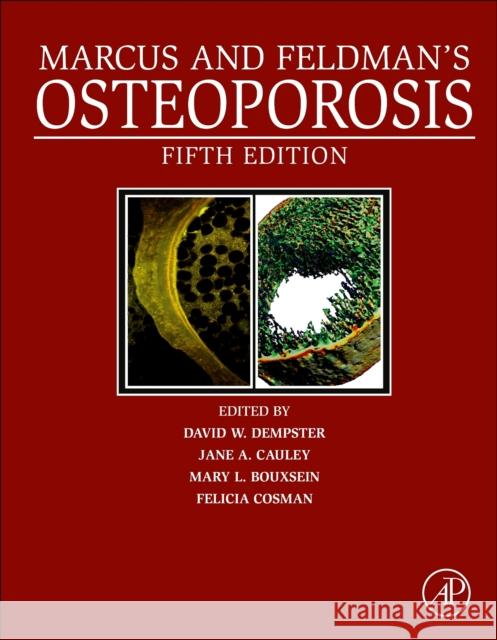 Marcus and Feldman's Osteoporosis David W. Dempster Jane A. Cauley Mary L. Bouxsein 9780128130735