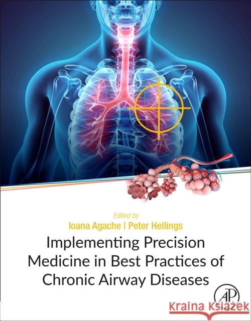Implementing Precision Medicine in Best Practices of Chronic Airway Diseases Ioana Agache Peter Hellings 9780128134719 Academic Press
