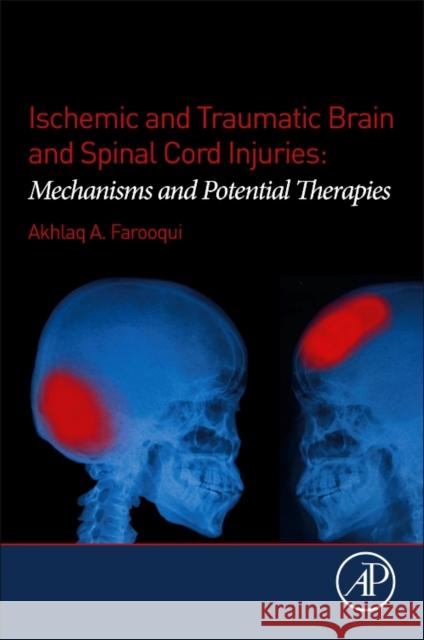 Ischemic and Traumatic Brain and Spinal Cord Injuries Farooqui, Akhlaq A. 9780128135969