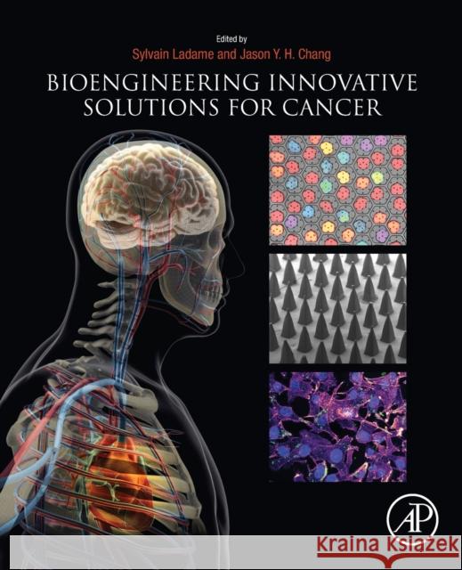 Bioengineering Innovative Solutions for Cancer Sylvain Ladame 9780128138861