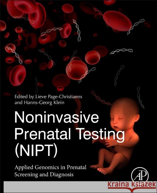 Noninvasive Prenatal Testing (Nipt): Applied Genomics in Prenatal Screening and Diagnosis Page-Christiaens, Lieve 9780128141892