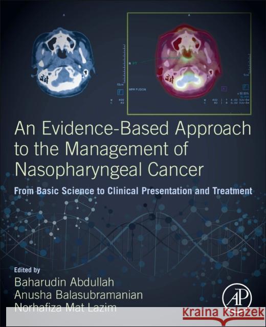 An Evidence-Based Approach to the Management of Nasopharyngeal Cancer: From Basic Science to Clinical Presentation and Treatment Baharudin Abdullah Anusha Balasubramanian Norhafiza Mat Lazim 9780128144039 Academic Press