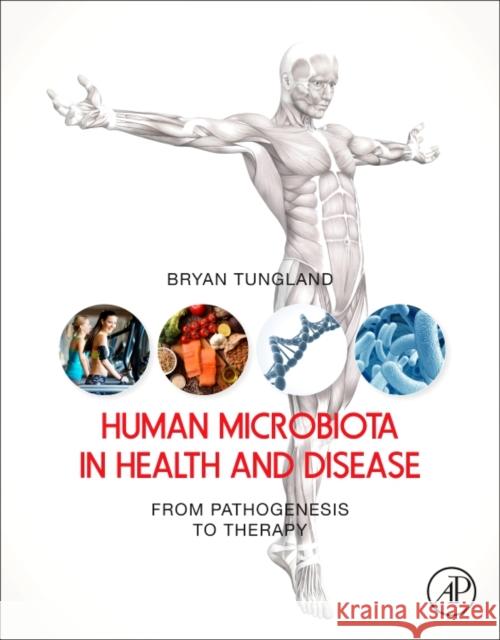 Human Microbiota in Health and Disease: From Pathogenesis to Therapy Bryan Tungland 9780128146491 Academic Press