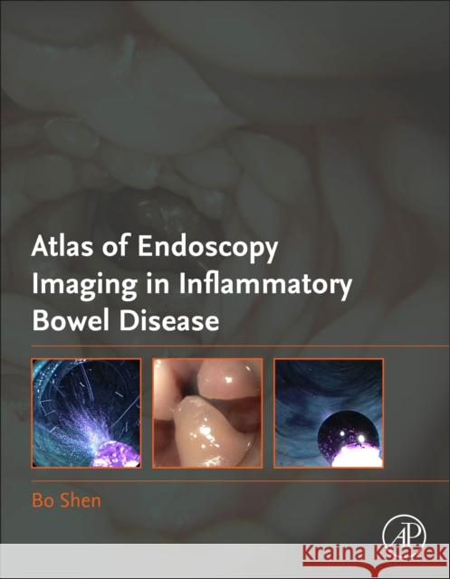 Atlas of Endoscopy Imaging in Inflammatory Bowel Disease Bo Shen 9780128148112 Academic Press